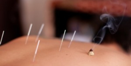Chinese Medicine Acupuncture 